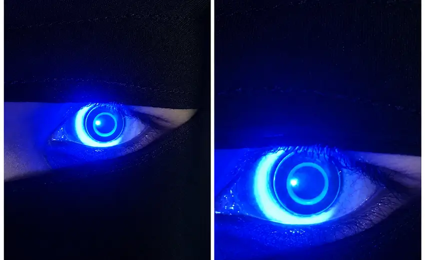 Contact Lens